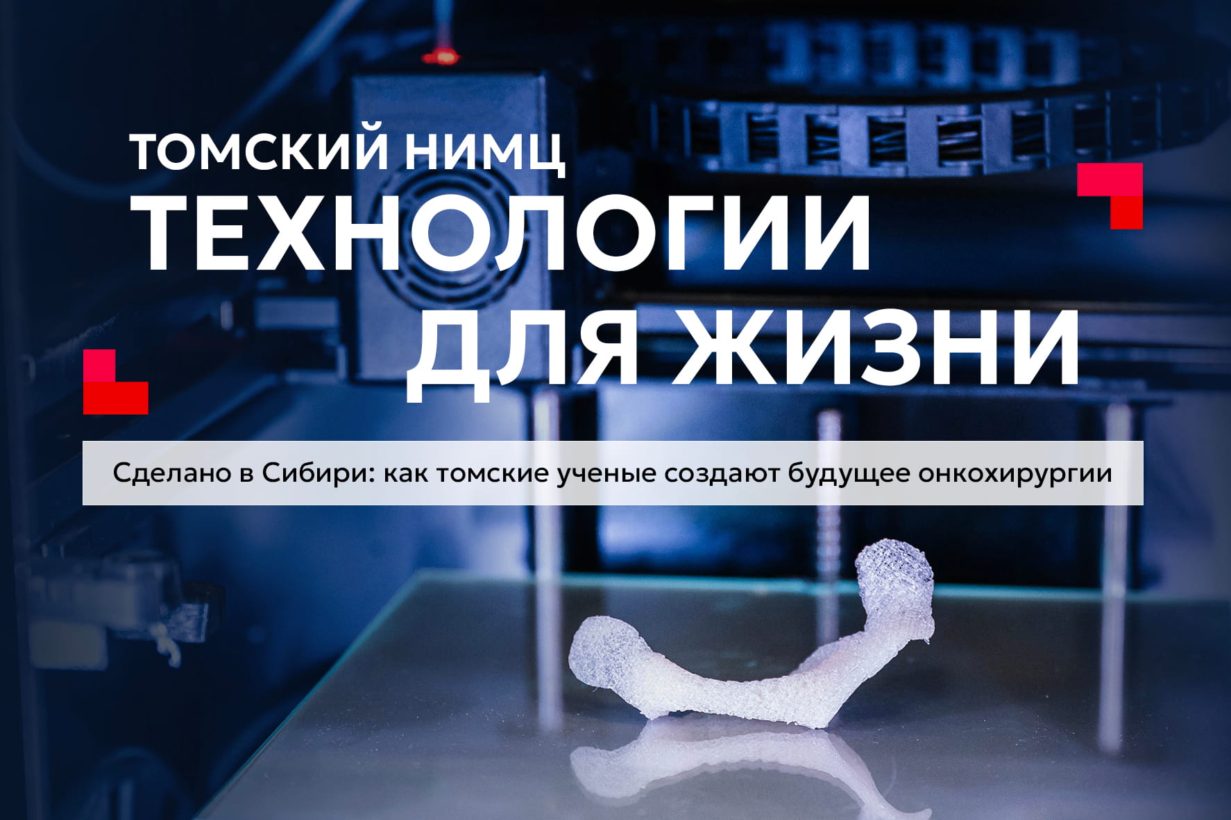 Made in Siberia: How Tomsk Scientists Are Shaping the Future of Oncologic Surgery